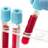 Single blood test to detect many types of cancer